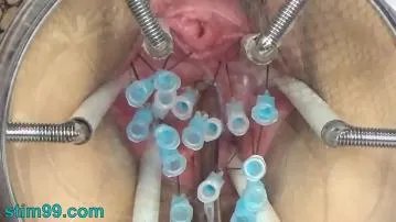 Extreme german bdsm inner pussy cervix and tits